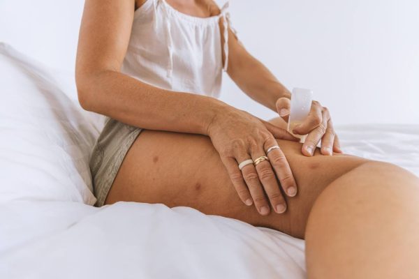 Remèdes naturels et soins complémentaires pour le prurigo nodulaire